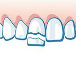 Notfall Zahn verschoben